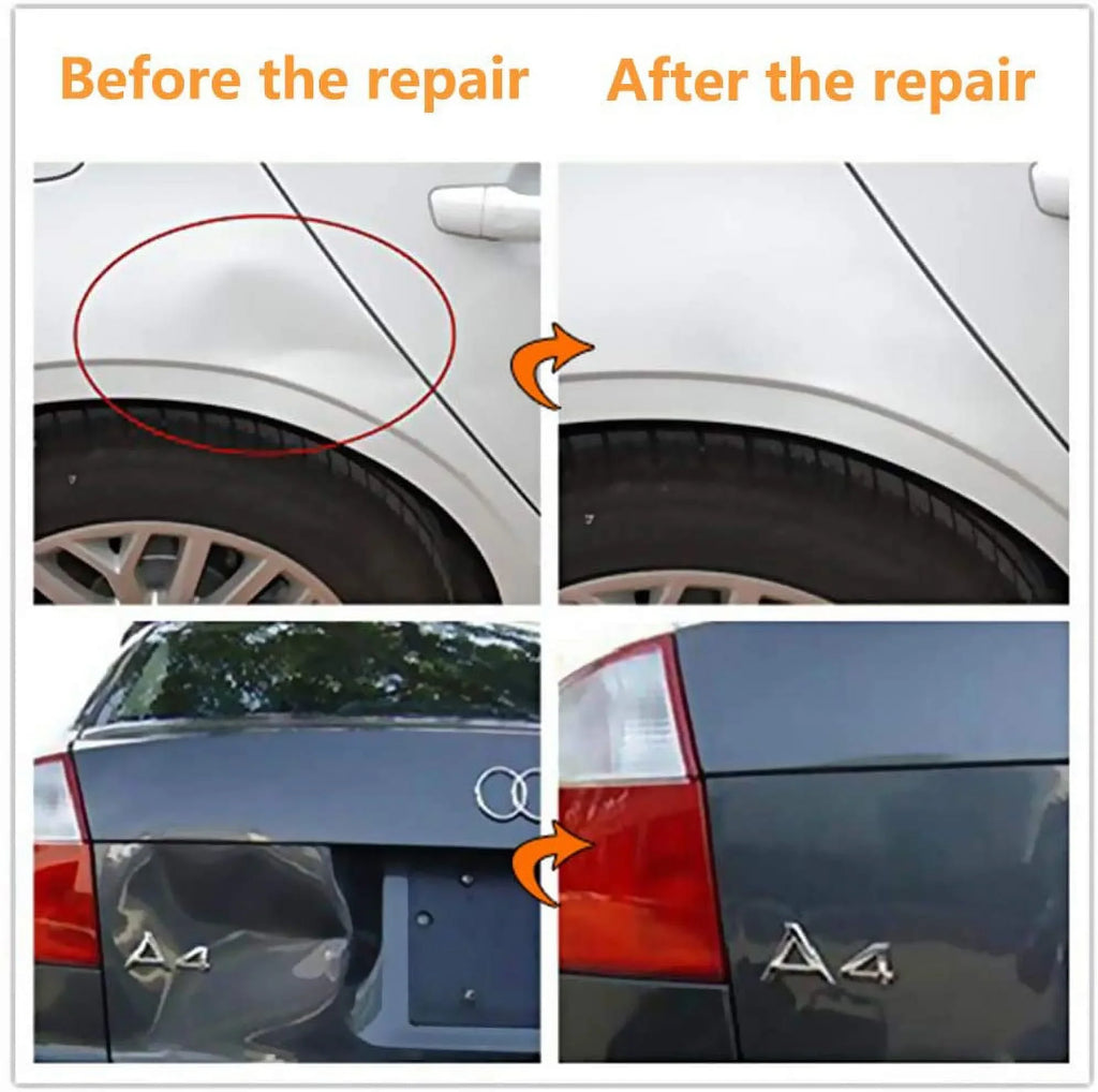 Dent Kits Dent PDR K06 Puller Bridge with DIY kit, Dent Paintless - Car Repair Auto Puller GLISTON Golden DENT Removal
